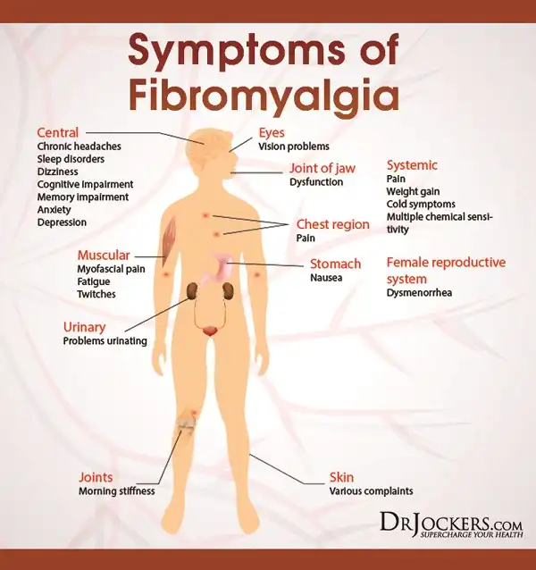 Fibromyalgia syndrome là gì